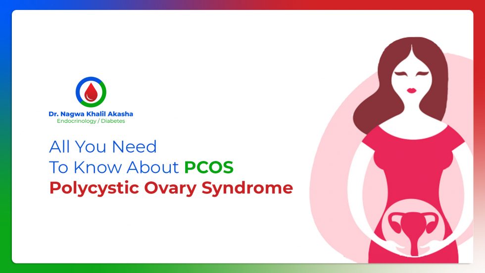 Polycystic Ovary Syndrome - PCOS Symptoms & Treatment