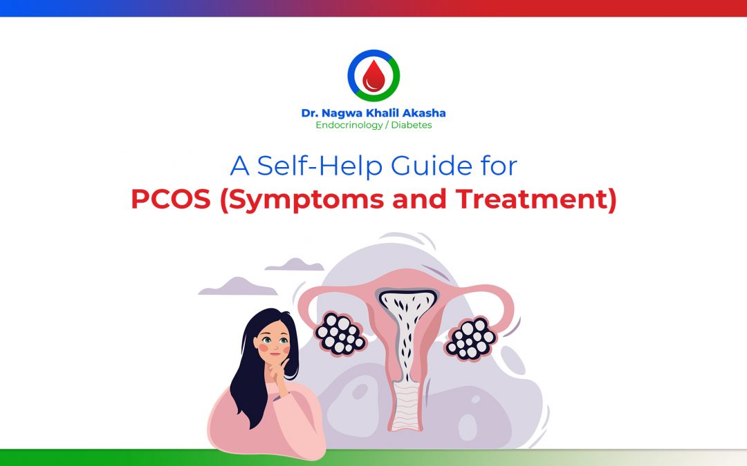 A Self-Help Guide for PCOS (Symptoms and Treatment)